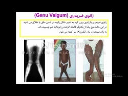 درس مبانی ورزش ابتدایی-- استادخانم سهیلا نجفی--  رشته آموزش ابتدایی الف و ب - ورودی 96